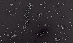 Negative Staining